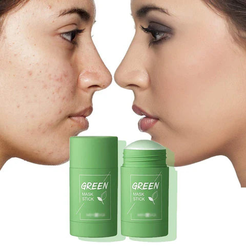 Green Mask – Máscara Removedora de Cravos, Oleosidade e manchas PAGUE 1 LEVE 3